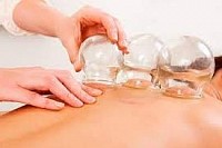 cupping fisioterapia